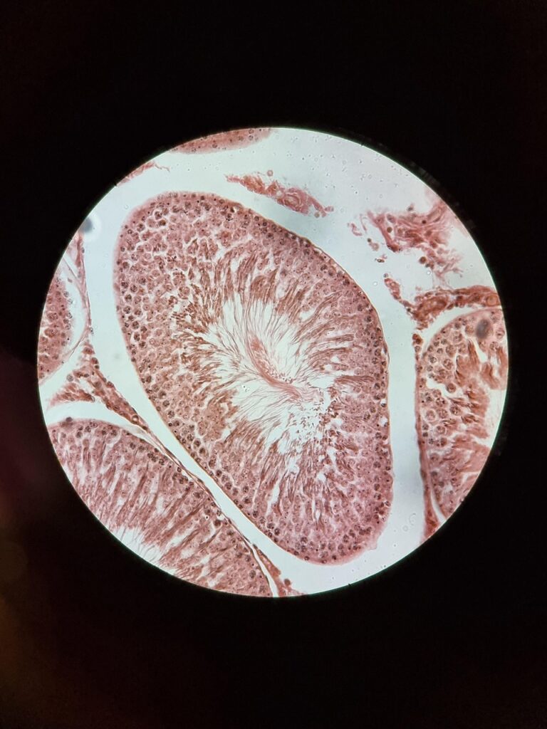 Microscopic view of stained tissue showing detailed cellular structures in pink and red tones within a circular field of view.