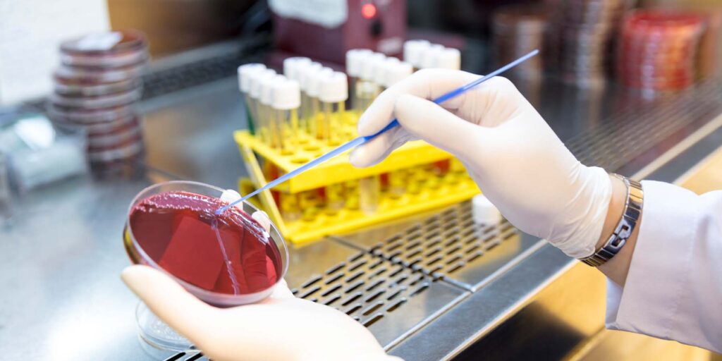 Researcher studying antimicrobial resistance