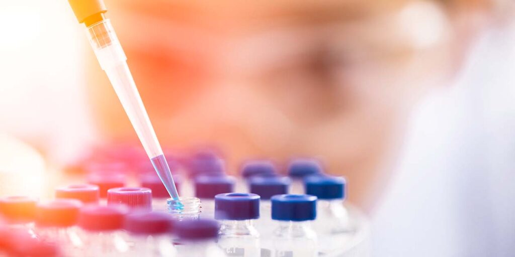 Researcher preforming a testosterone assay
