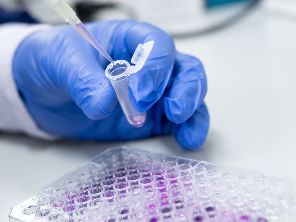 Scientist working on a 96 well micro plate and pipettes
