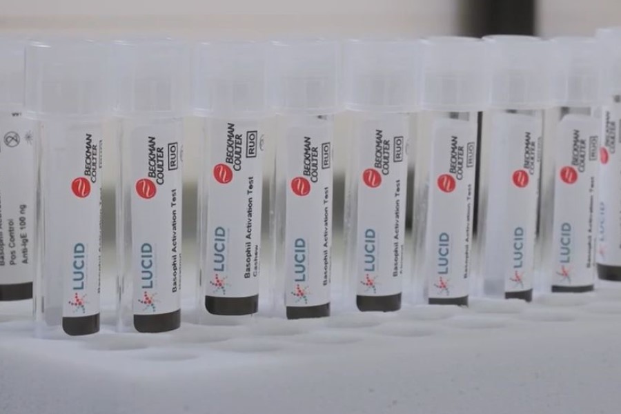 Food allergy testing kit BAT