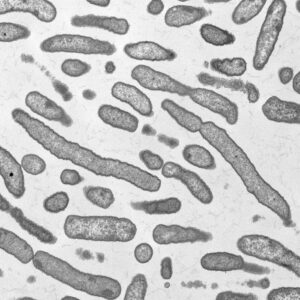 Transmission Electron Microscopy TEM