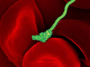 CDC scanning electron micrograph (SEM) of Borrelia hermsii bacterium