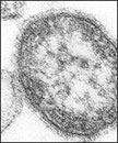 Measle Microscope Image