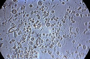 Herpes Simplex Virus, HSV Testing