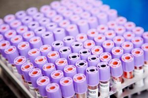 Toxicological Risk Assessment