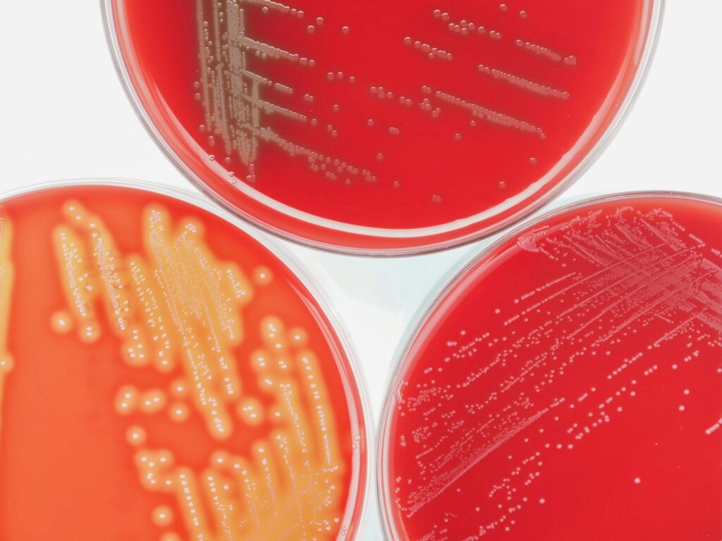 Close up of three blood agar plates showing microbial growth.