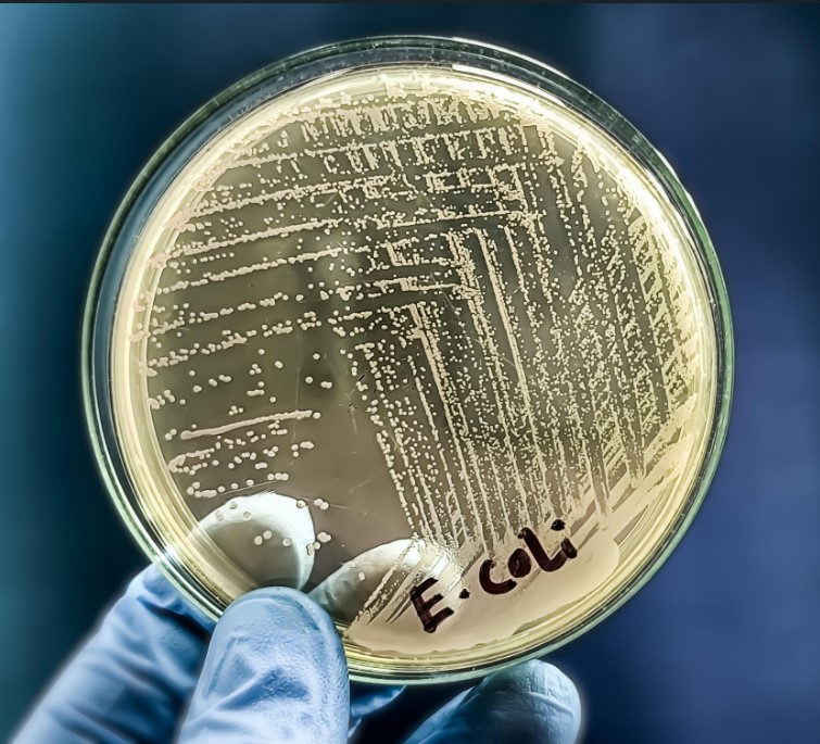 Image of a gloved hand holding a Petri dish with a bacterial smaer of E. coli bacteria again showing the importance of microbiological testing