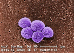 MRSA Bacteria Magnified 20,000X