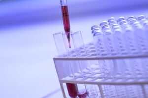 Image of a dropper placing an immonoassay solution into a test tube