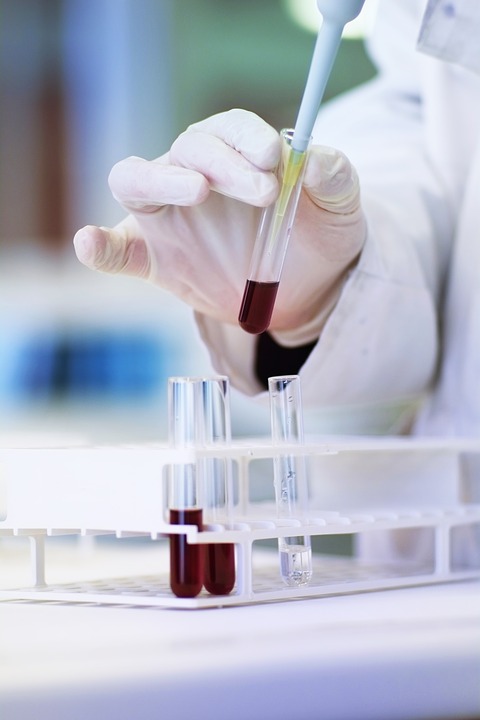 image of a scientist working with a vial of blood