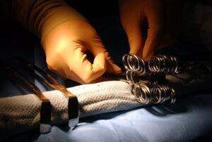 sterility assurance level